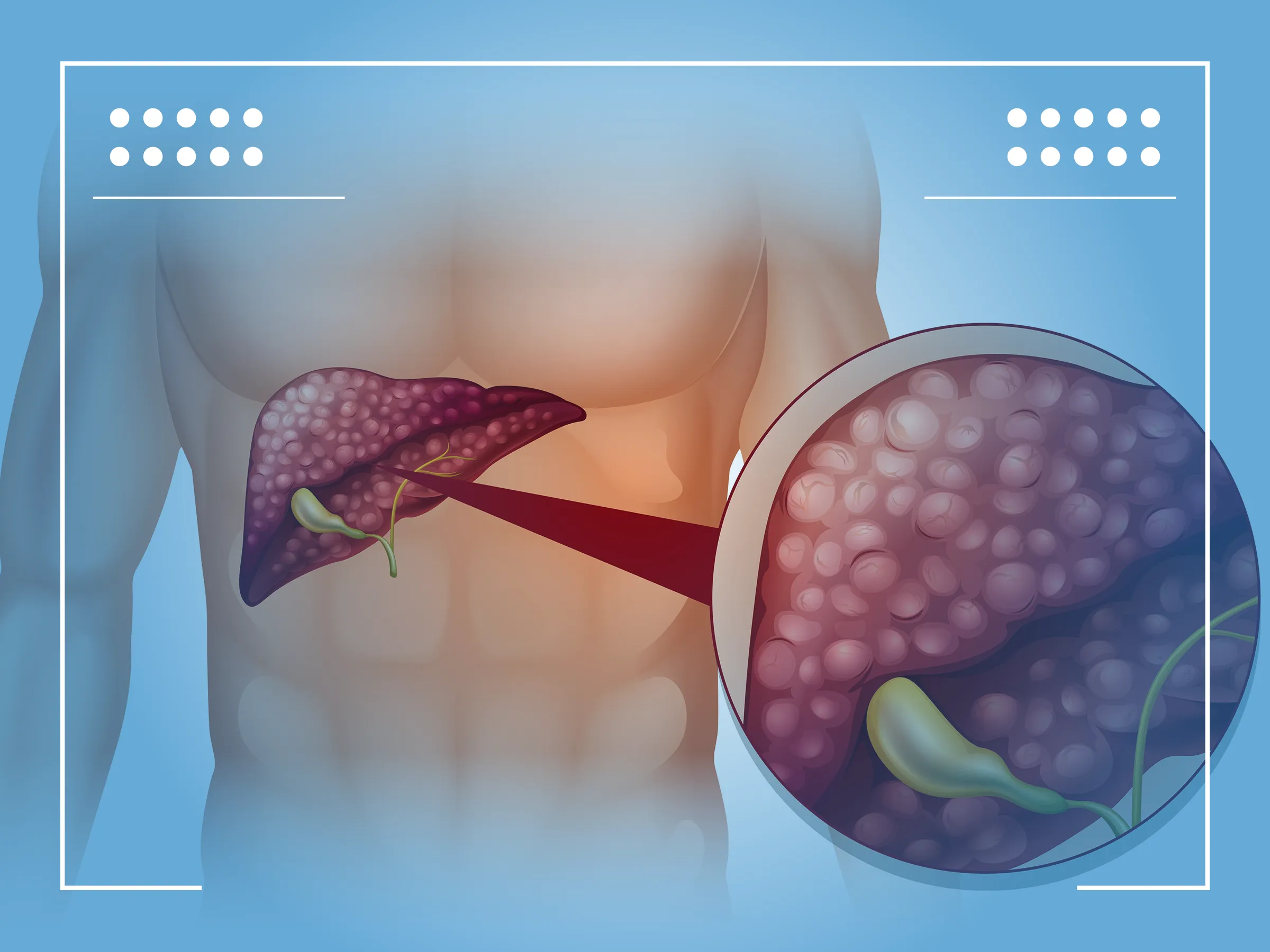 Rumore Al Fegato Si Guarisce