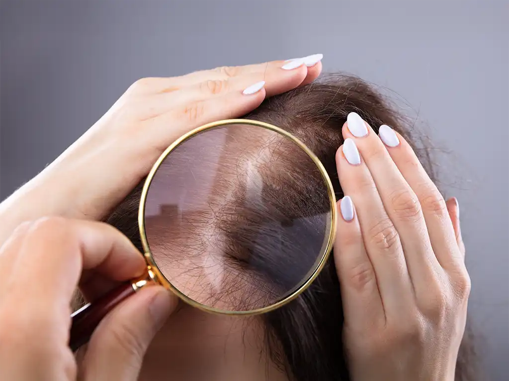 Hautkrebs auf der Kopfhaut: Symptome, Behandlung und Vorbeugung