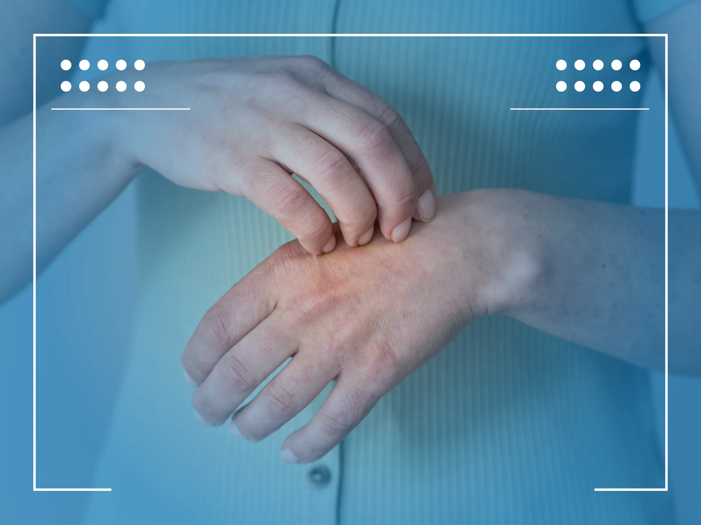 Câncer de Pele Coça