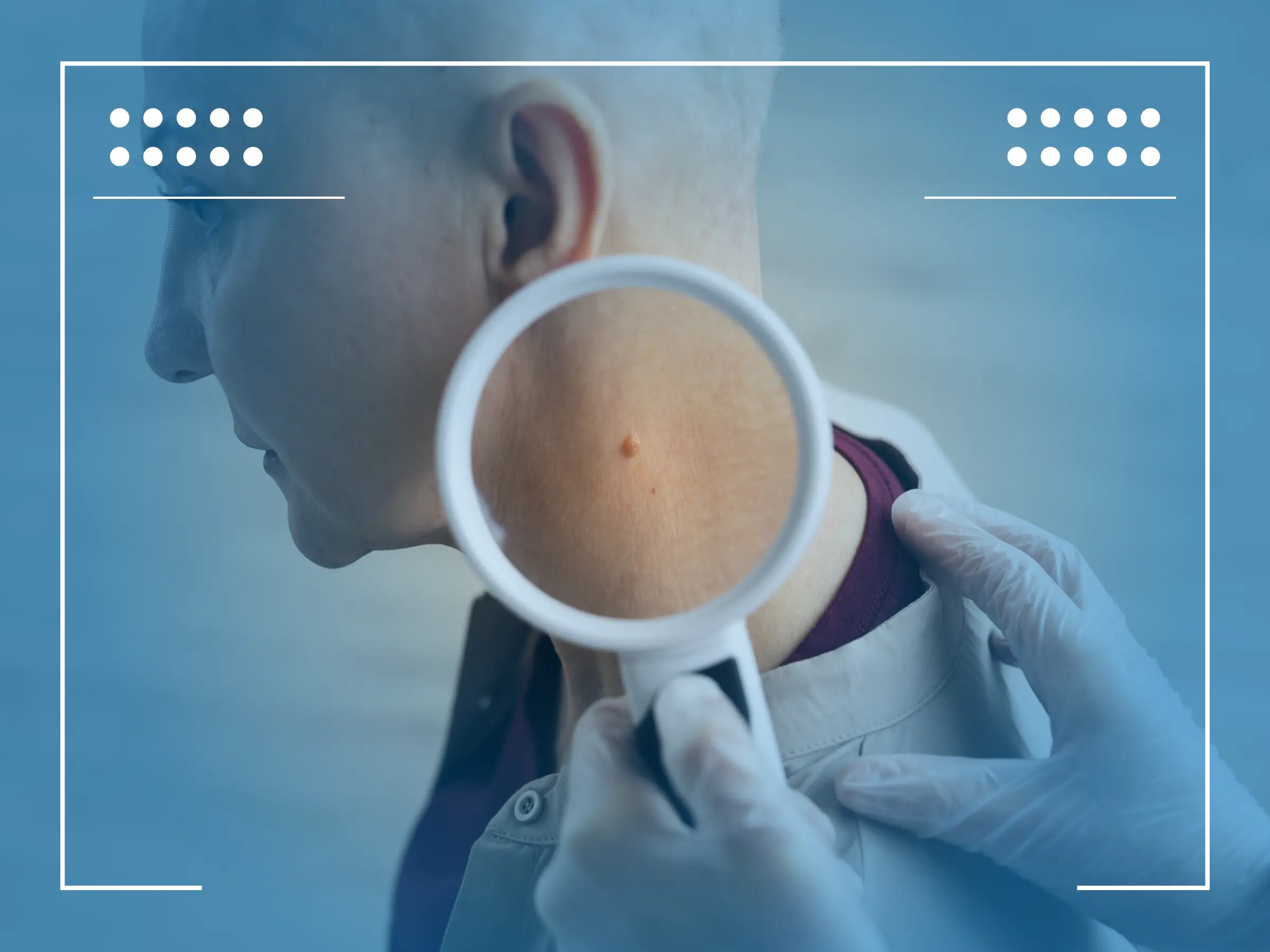 Rak Jelita Grubego Objawy Skórne