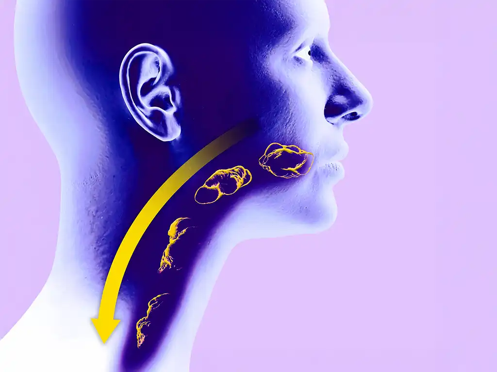 Esophageal Cancer Warning Signs