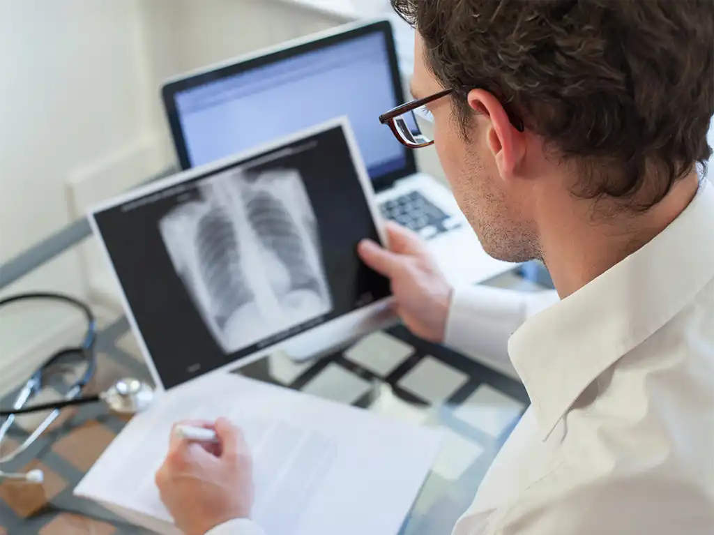 Understanding Limited Stage Small Cell Lung Cancer