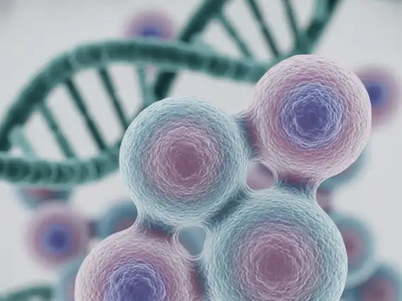 Thymoma Stages