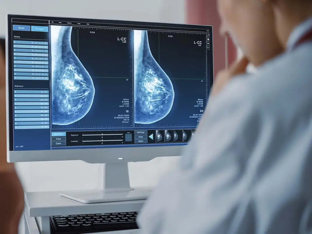 Early-Stage Inflammatory Breast Cancer: What It Looks Like