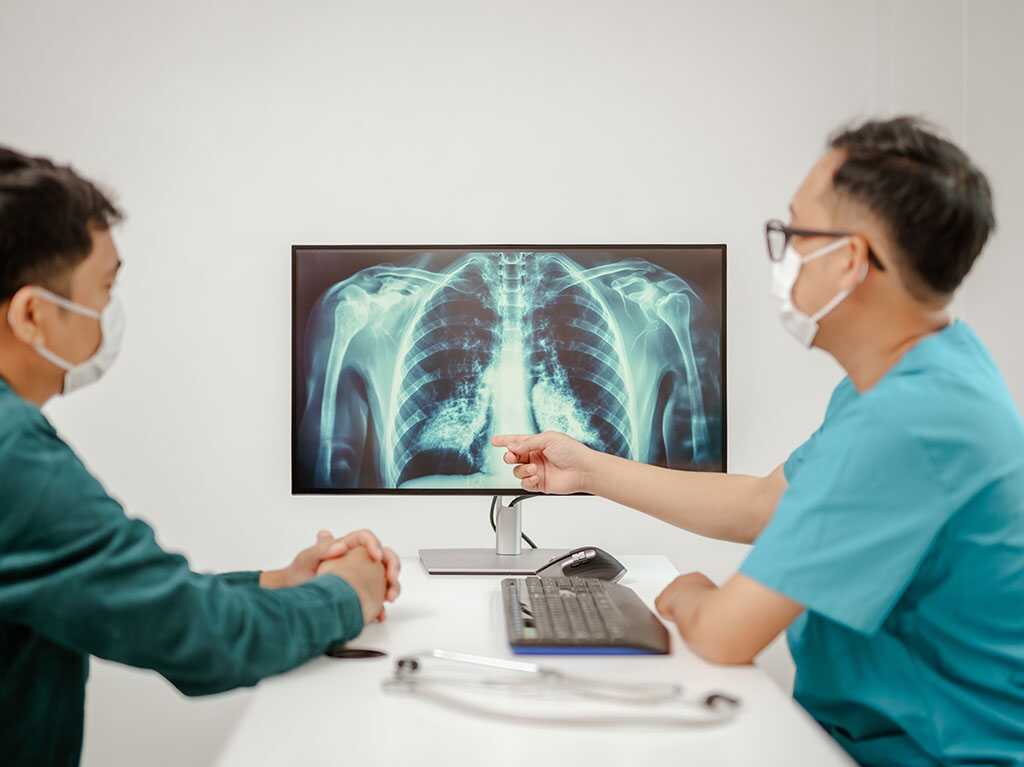 Cancer du poumon non à petites cellules vs. autres types : différences clés