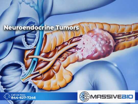Neuroendocrine Tumors