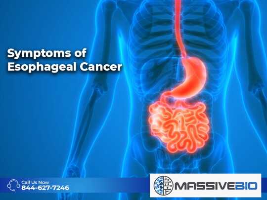 Symptoms of Esophageal Cancer – Esophagus Cancer Signs