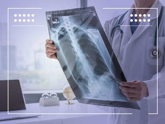 Comprendere il Carcinoma Polmonare ROS1-Positivo: Differenze e Prospettive