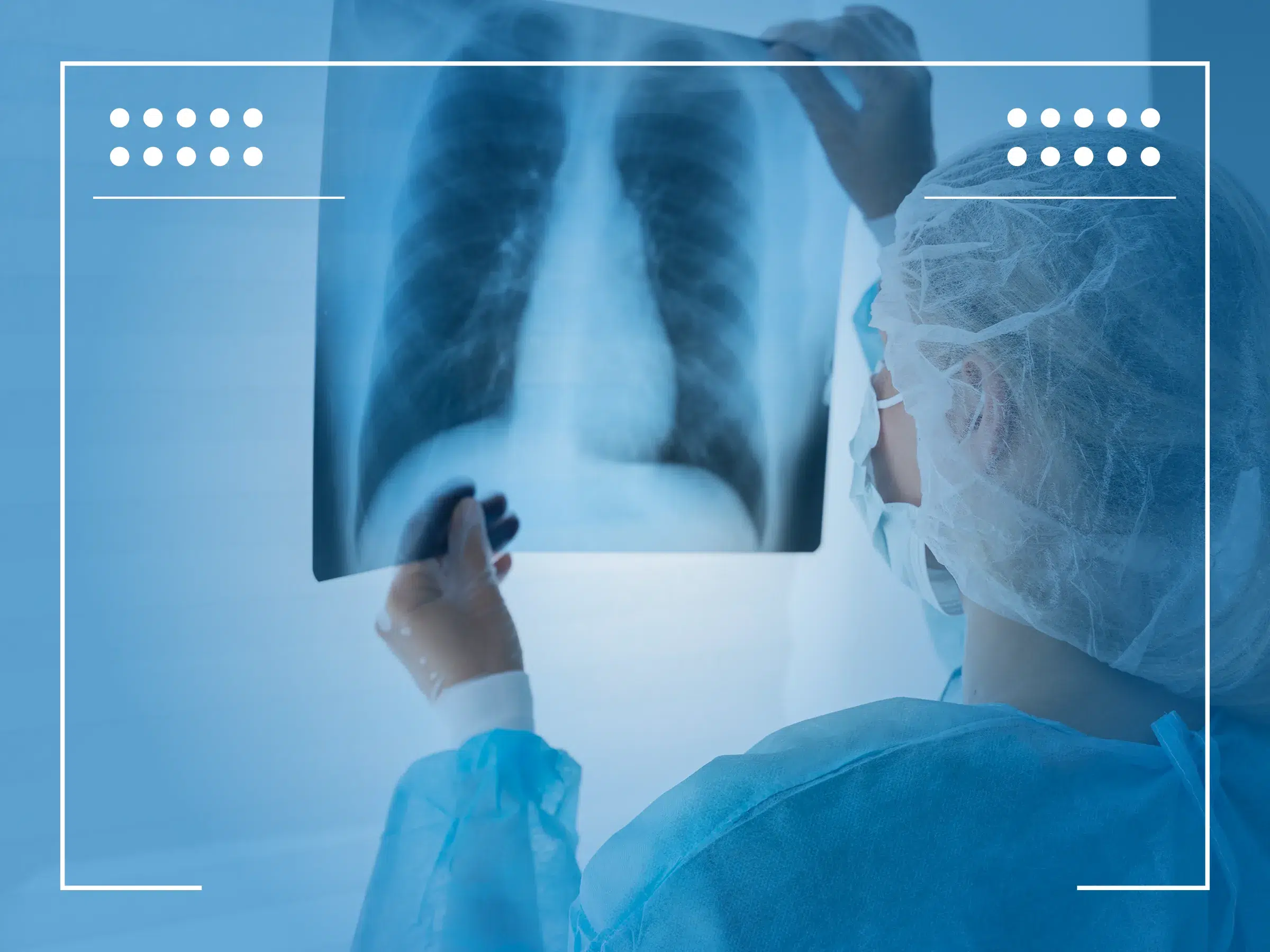 Cáncer de pulmón tratamiento