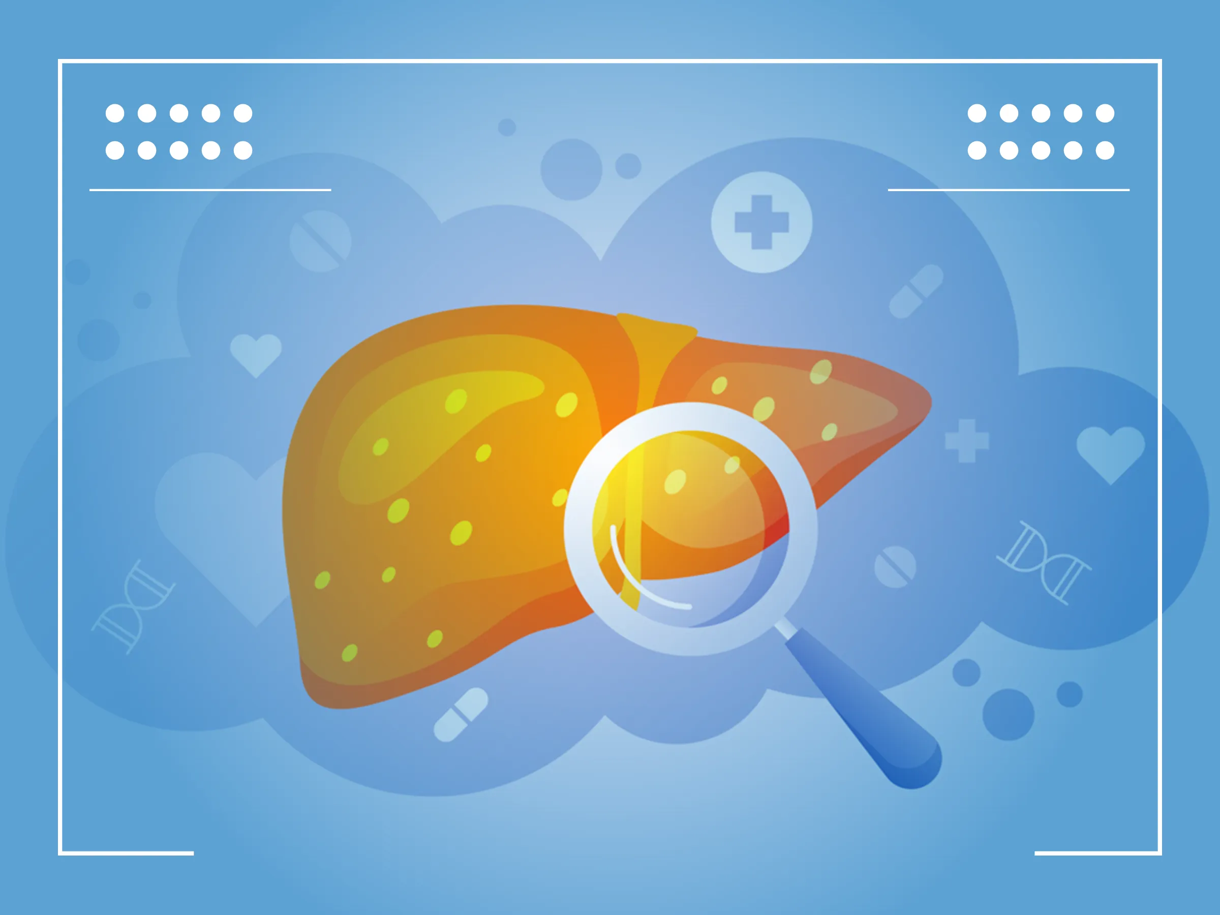 Cáncer Hígado Esperanza de Vida