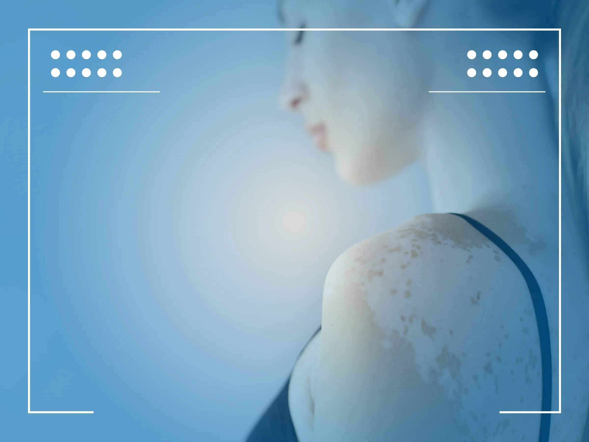 βασικοκυτταρικό καρκίνωμα