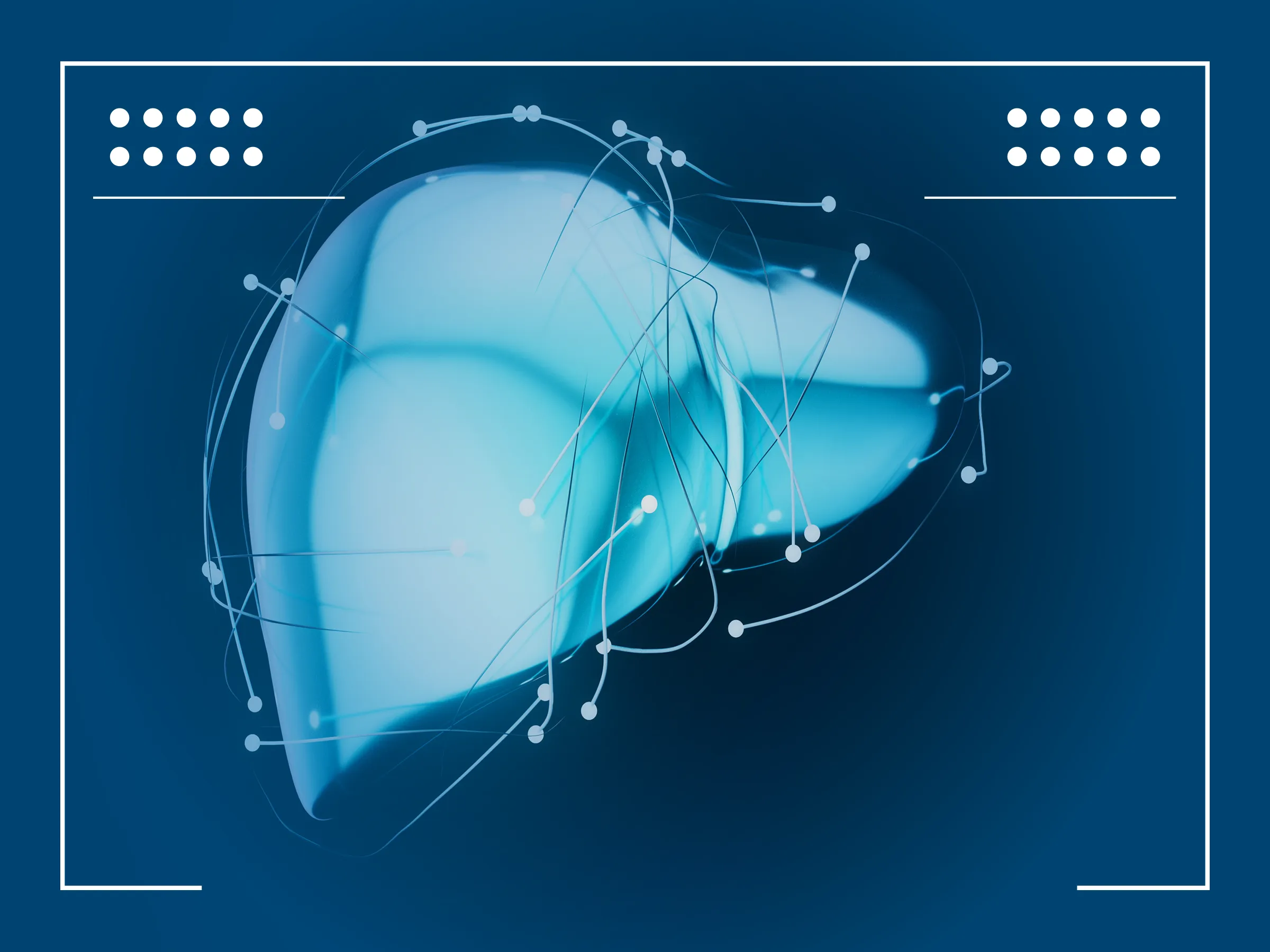 Hepatocellular Carcinoma