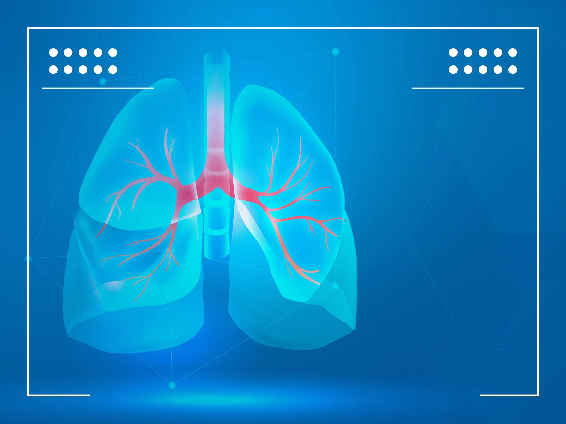 Lungenkrebs Stadium 4