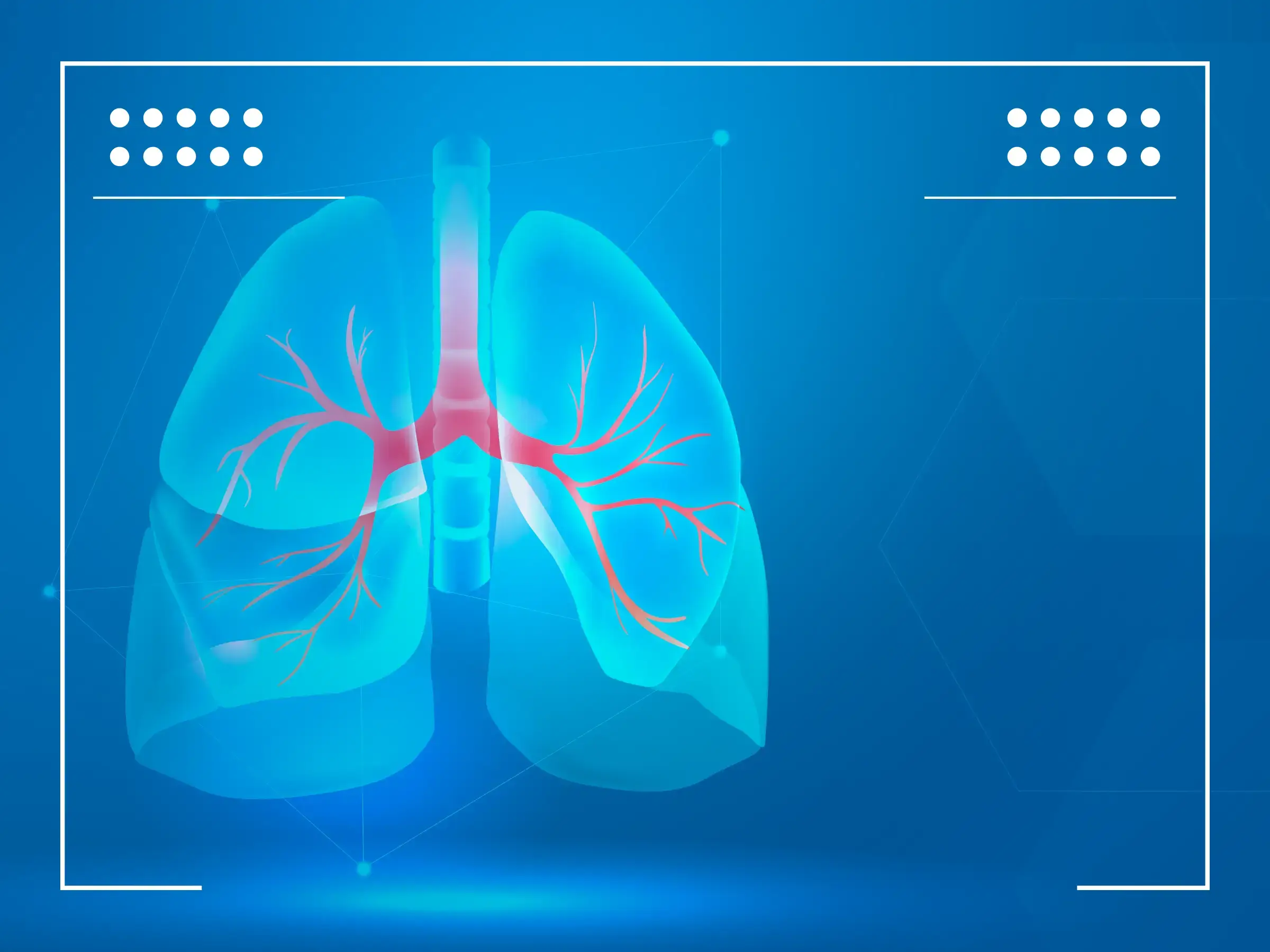 Przerzuty raka płuc