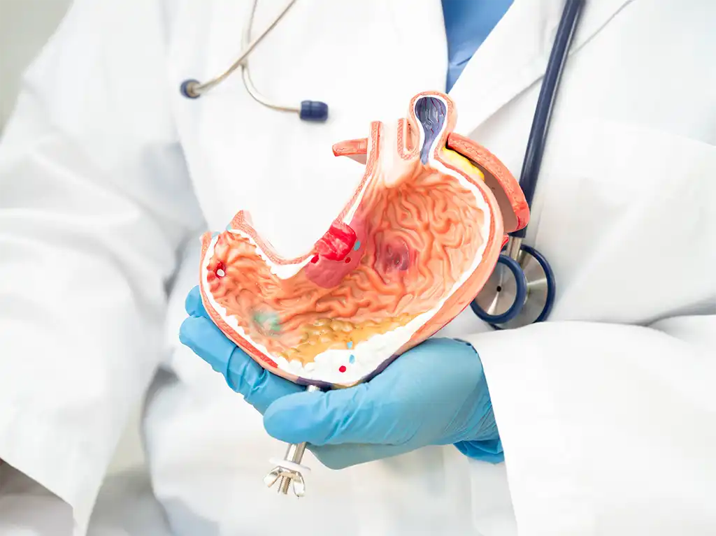 Magenkrebs: Symptome, Diagnose und Behandlung für eine bessere Prognose