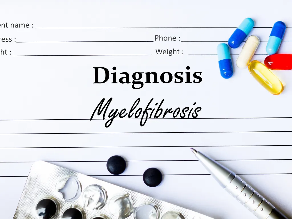 How Is Myelofibrosis Diagnosed? A Step-by-Step Guide
