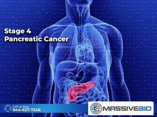 Stage 4 Pancreatic Cancer