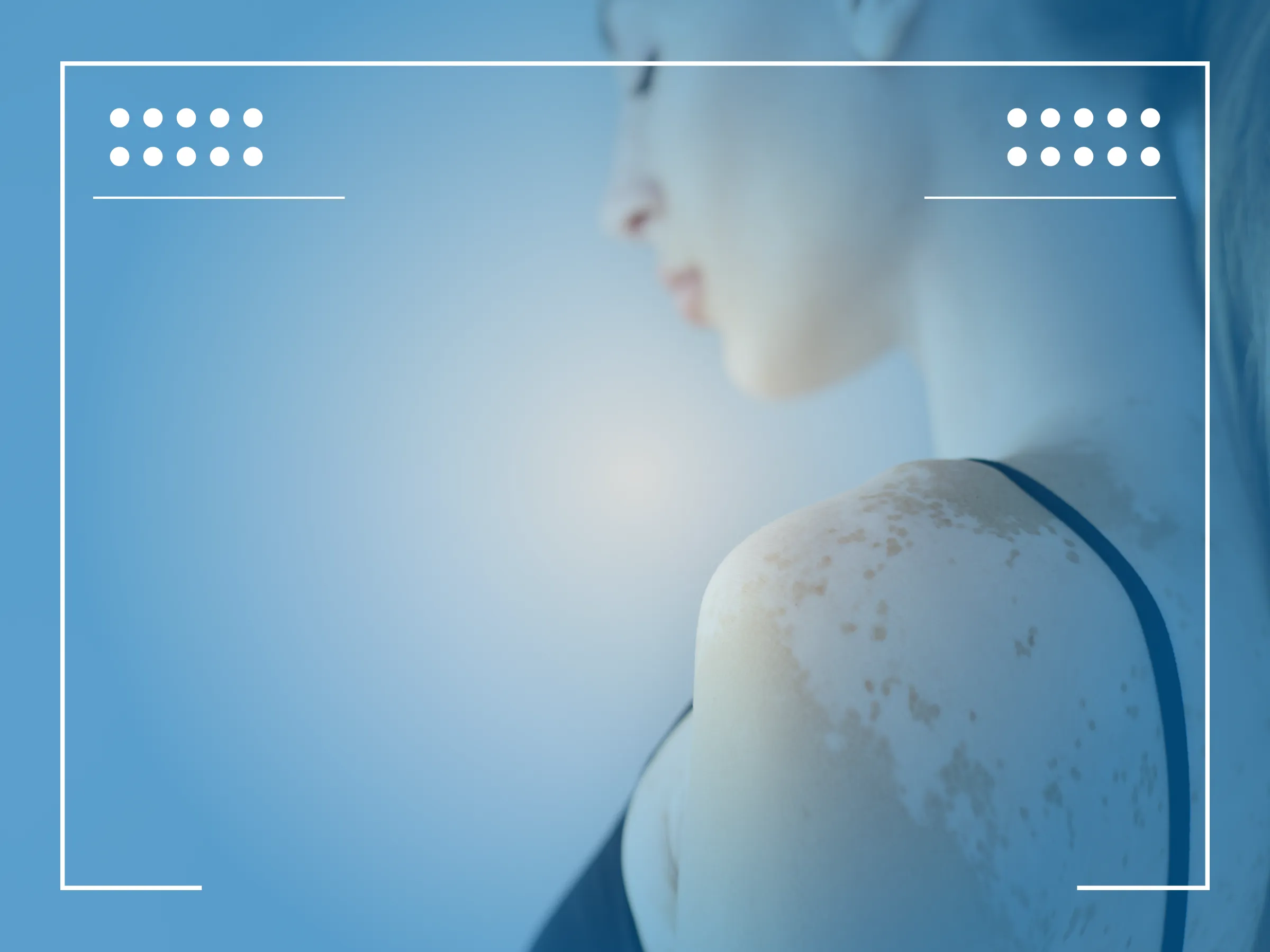 Rak Jelita Grubego Objawy Skórne