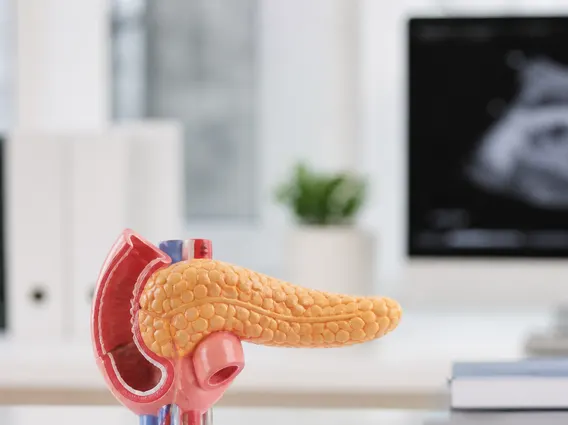 Stage Ii Pancreatic Cancer