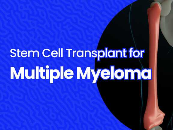 Stem Cell Transplant for Multiple Myeloma  