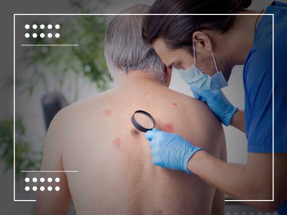 Melanoma Guide: Causes, Symptoms, and Risk Factors