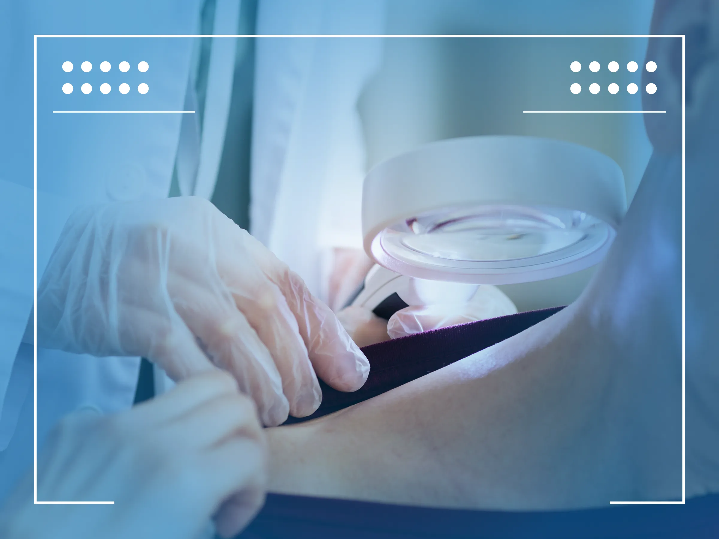 Câncer De Pele Tratamento