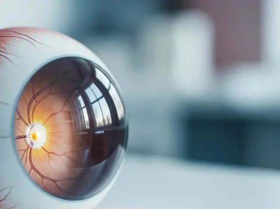 Retinoblastoma Signs & Symptoms