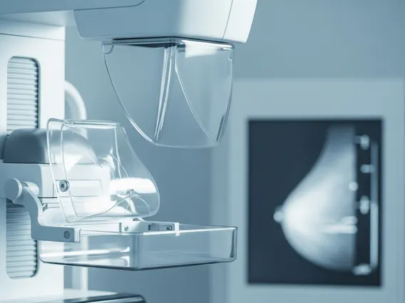 Eklund Displacement Views