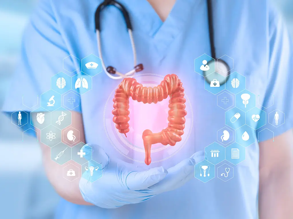 ¿Qué es el cáncer colorrectal? Etapas y tasas de supervivencia